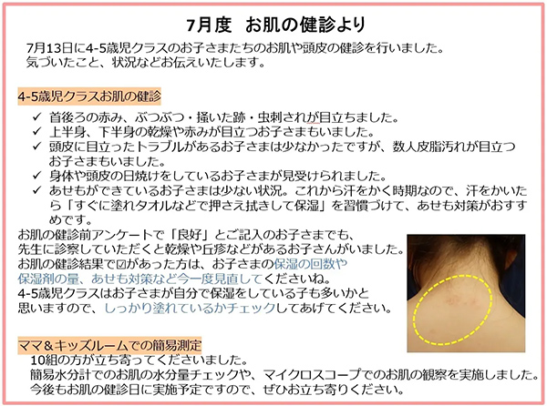 7月度 お肌の健診より